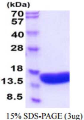 SDS-PAGE: Recombinant Human VAMP-2 His Protein [NBP2-59931]