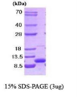 SDS-PAGE: Recombinant Human VAMP3/Cellubrevin Protein [NBC1-18346]