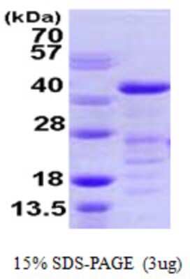 SDS-PAGE: Recombinant Human VASP His Protein [NBP1-51073]