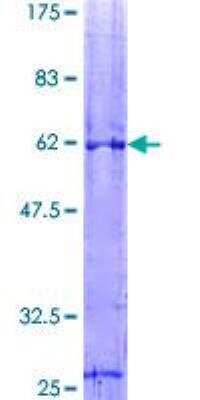 SDS-PAGE: Recombinant Human VDAC1 GST (N-Term) Protein [H00007416-P01]