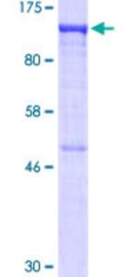 SDS-PAGE: Recombinant Human VDP p115 GST (N-Term) Protein [H00008615-P01]