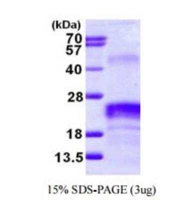 SDS-PAGE: Recombinant Human VEGF 165 His Protein [NBP1-72489]