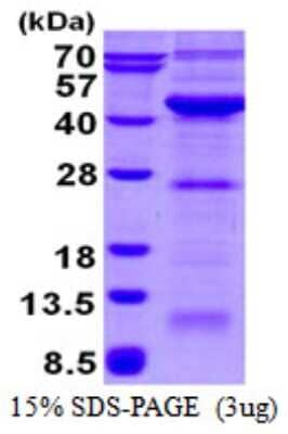 SDS-PAGE: Recombinant Human VPS26A His Protein [NBP1-98890]