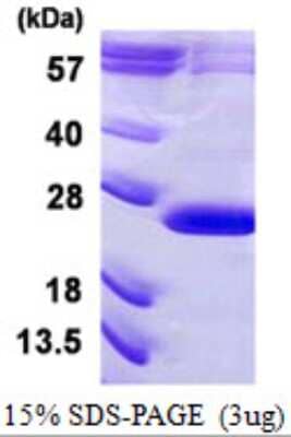 SDS-PAGE: Recombinant Human VPS29 His Protein [NBP1-99036]