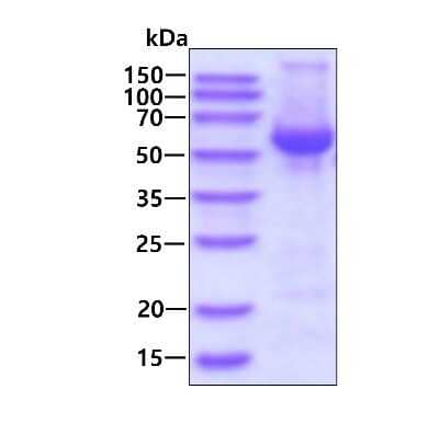 SDS-PAGE: Recombinant Human VPS4B His Protein [NBP2-22937]