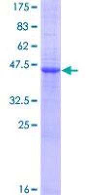 SDS-PAGE: Recombinant Human VSTM1 GST (N-Term) Protein [H00284415-P01]