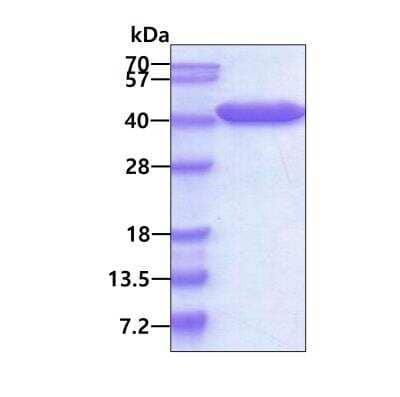 SDS-PAGE: Recombinant Human VTA1 His Protein [NBP1-99098]