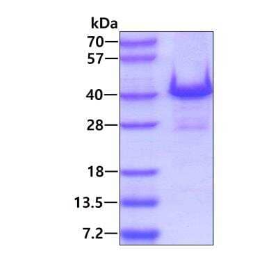 SDS-PAGE: Recombinant Human WBP2 His Protein [NBP2-22948]