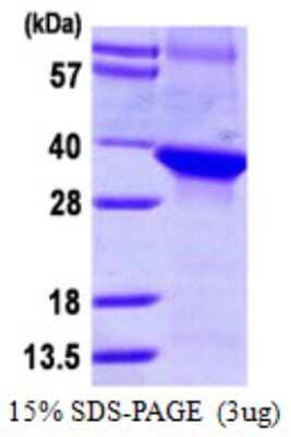 SDS-PAGE: Recombinant Human WDR68 His Protein [NBP1-72421]