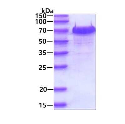 SDS-PAGE: Recombinant Human WHSC2 His Protein [NBP1-50940]