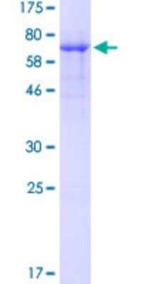 SDS-PAGE: Recombinant Human WTAP GST (N-Term) Protein [H00009589-P01]