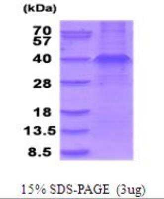 SDS-PAGE: Recombinant Human Wnt-3a Protein [NBP2-51946]