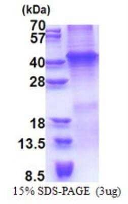 SDS-PAGE: Recombinant Human Wnt-7a His Protein [NBP2-22946]