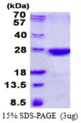 SDS-PAGE: Recombinant Human XLF His Protein [NBP2-23291]