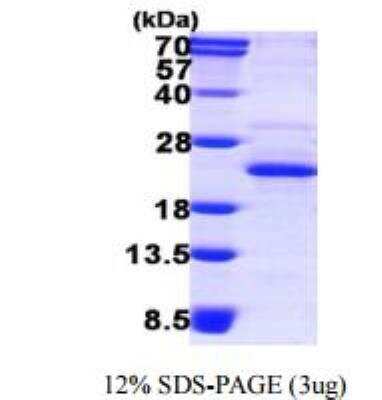 SDS-PAGE: Recombinant Human XTP3TPA His Protein [NBP1-78880]