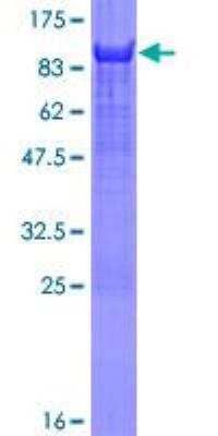 SDS-PAGE: Recombinant Human YAP1 GST (N-Term) Protein [H00010413-P01]