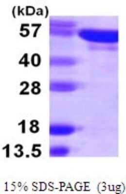 SDS-PAGE: Recombinant Human YARS His Protein [NBP1-72303]