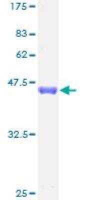 SDS-PAGE: Recombinant Human YSK4 GST (N-Term) Protein [H00080122-P01]