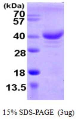 SDS-PAGE: Recombinant Human ZCCHC17 His Protein [NBP1-51047]