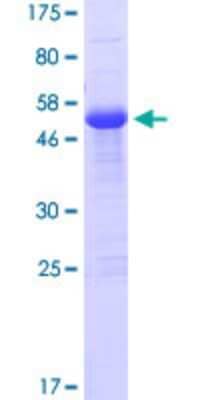 SDS-PAGE: Recombinant Human ZFAND2B GST (N-Term) Protein [H00130617-P01]