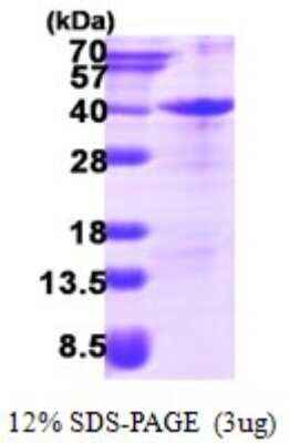 SDS-PAGE: Recombinant Human ZFAND3 His Protein [NBP1-78884]