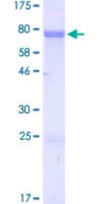 SDS-PAGE: Recombinant Human ZIC3 GST (N-Term) Protein [H00007547-P01]