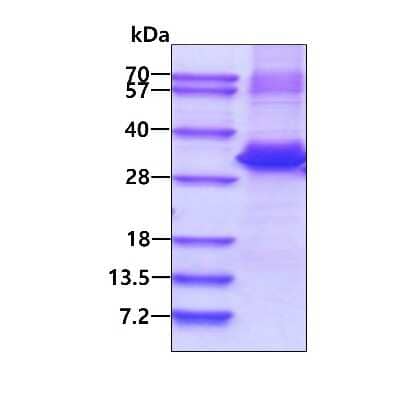 SDS-PAGE: Recombinant Human ZNF313 His Protein [NBP2-51614]