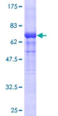 SDS-PAGE: Recombinant Human actin, gamma 2 GST (N-Term) Protein [H00000072-P01]