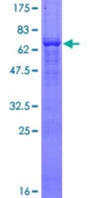 SDS-PAGE: Recombinant Human actin, gamma 2 GST (N-Term) Protein [H00000072-P02]