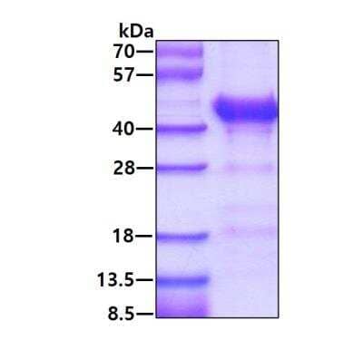 SDS-PAGE: Recombinant Human alcohol dehydrogenase 1A His Protein [NBP1-99087]