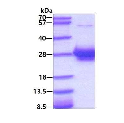 SDS-PAGE: Recombinant Human alpha 1-Microglobulin His Protein [NBP1-72498]