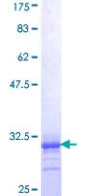 SDS-PAGE: Recombinant Human alpha-1A Adrenergic R/ADRA1A GST (N-Term) Protein [H00000148-Q01]