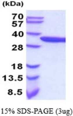 SDS-PAGE: Recombinant Human alpha-Actinin 1 His Protein [NBP2-59725]