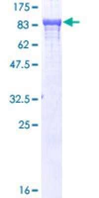 SDS-PAGE: Recombinant Human alpha Adducin GST (N-Term) Protein [H00000118-P01]