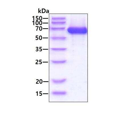 SDS-PAGE: Recombinant Human alpha-Fetoprotein/AFP His Protein [NBP2-52171]