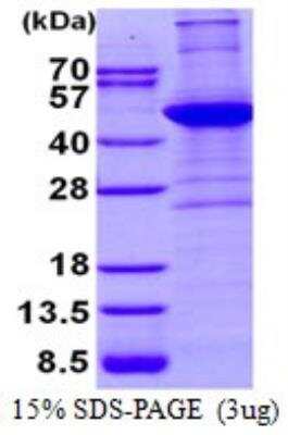 SDS-PAGE: Recombinant Human alpha-Smooth Muscle Actin His Protein [NBP2-22670]