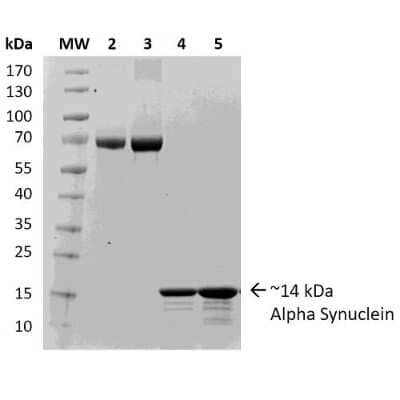 SDS-PAGE: Recombinant Human alpha-Synuclein Active, Monomer, (Type 2) Protein [NBP2-54786]