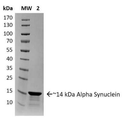 Western Blot: Recombinant Human alpha-Synuclein Active, Pre-formed Fibrils, (Type 2) Protein [NBP2-54787]