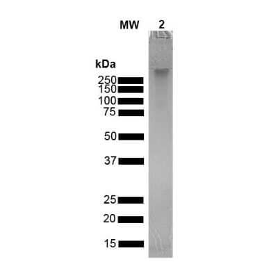 SDS-PAGE: Recombinant Human alpha-Synuclein Oligomers, (Dopamine HCL Stabilized) Protein [NBP3-14772]