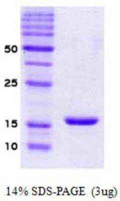 SDS-PAGE: Recombinant Human alpha-Synuclein Protein [NBP2-22845]