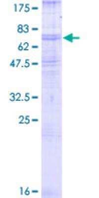 SDS-PAGE: Recombinant Human beta-2 Adrenergic R/ADRB2 GST (N-Term) Protein [H00000154-P01]