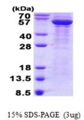 SDS-PAGE: Recombinant Human beta-III Tubulin His Protein [NBP2-22901]