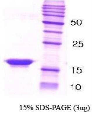 SDS-PAGE: Recombinant Human beta-Synuclein Protein [NBC1-18328]