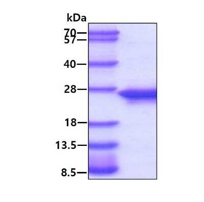 SDS-PAGE: Recombinant Human c-Myc-responsive protein Rcl His Protein [NBP1-48353]