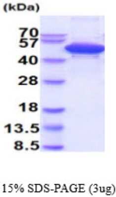 SDS-PAGE: Recombinant Human cleavage stimulation factor His Protein [NBP2-59594]