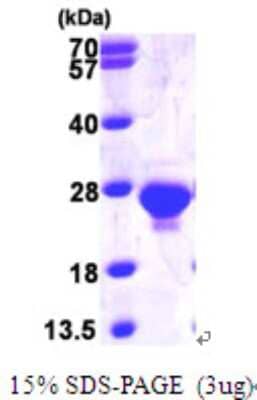 SDS-PAGE: Recombinant Human dUTPase His Protein [NBP1-48598]