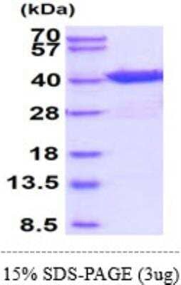 SDS-PAGE: Recombinant Human eIF2 alpha/EIF2S1 His Protein [NBP1-44467]