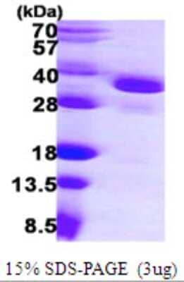 SDS-PAGE: Recombinant Human eIF2B1 His Protein [NBP1-51089]