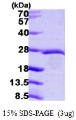 SDS-PAGE: Recombinant Human eIF3K His Protein [NBP1-51042]