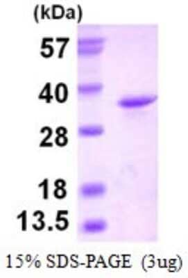 SDS-PAGE: Recombinant Human eIF4H His Protein [NBP1-98965]